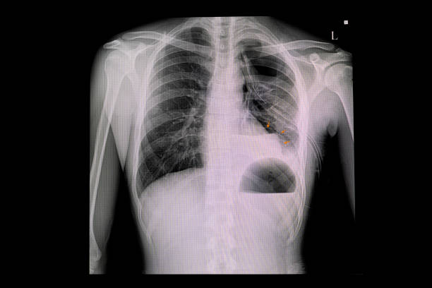 x-ray of person's torso